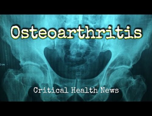 Osteoarthritis