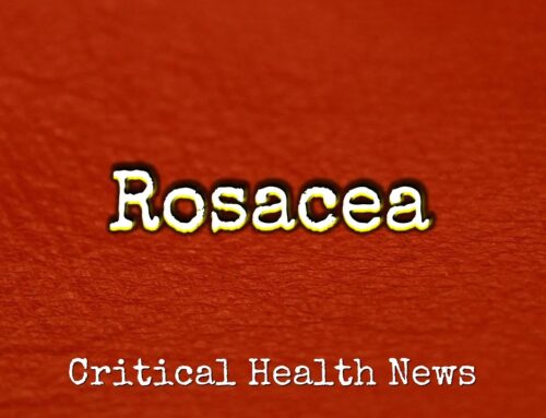 Rosacea: A Skin Condition That Can Be Managed at Home